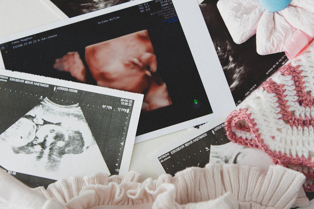 Ultrasound images surrounded by baby clothing and accessories, symbolizing pregnancy and motherhood.